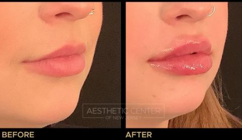 Website B&A Gallery - 29