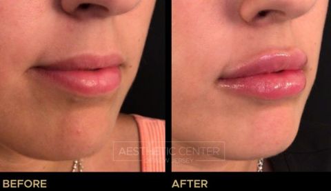 Website B&A Gallery - 33