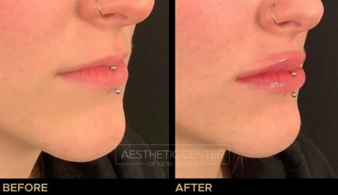 Website B&A Gallery - 31