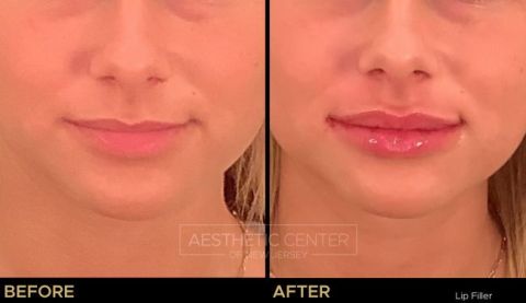 Feb 2023 B&A - 79