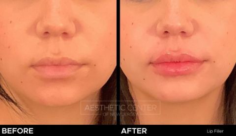 Feb 2023 B&A - 77
