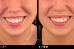 Website B&A Gallery - 57
