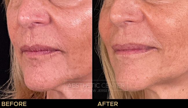 Website B&A Gallery - 145