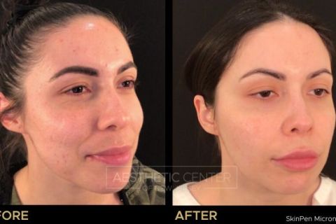 Feb 2023 B&A - 81
