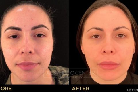 Feb 2023 B&A - 83