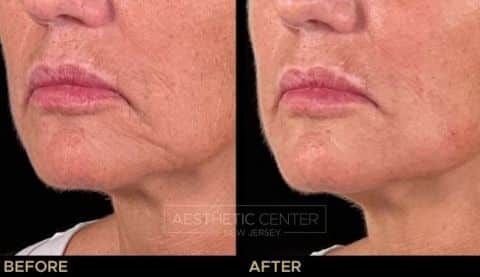 Website B&A Gallery - Lisa Tillette (2)