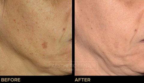 Website B&A Gallery - 1