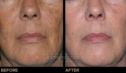 Website B&A Gallery - 5