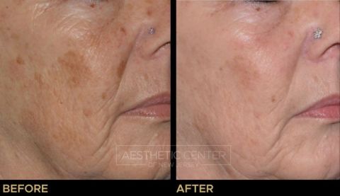 Website B&A Gallery - 6