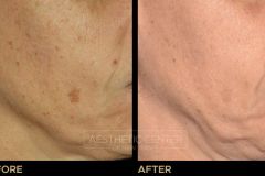 Website B&A Gallery - 1