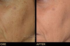 Website B&A Gallery - 2