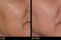 Website B&A Gallery - 3
