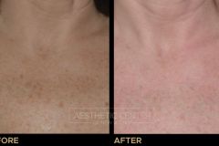Website B&A Gallery - 4