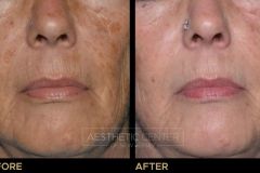 Website B&A Gallery - 5