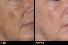 Website B&A Gallery - 6