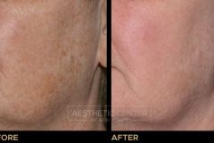 Website B&A Gallery - 10