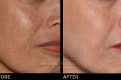 Website B&A Gallery - 13