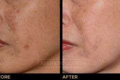 Website B&A Gallery - 14