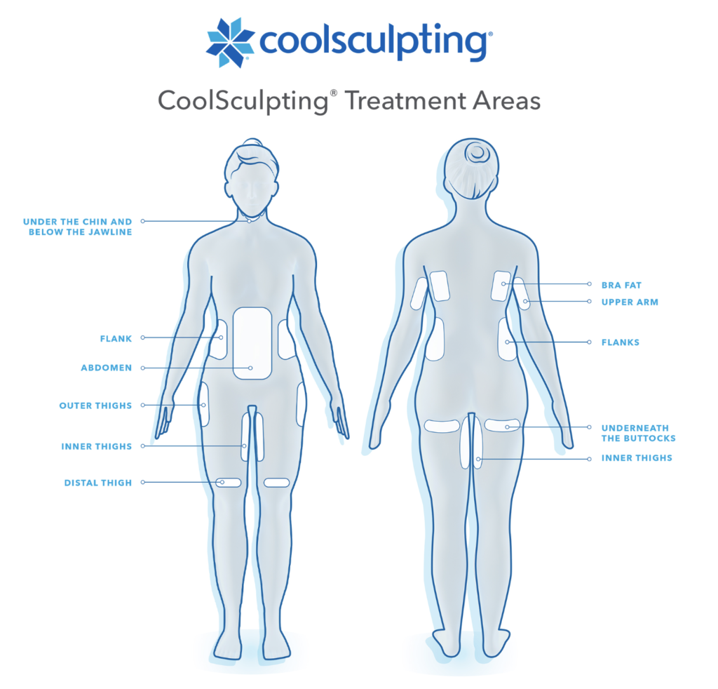 CoolSculpting For Bra Fat - Cutis Dermatology