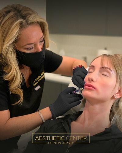 Woman getting lip filler injections with Restylane Kysse