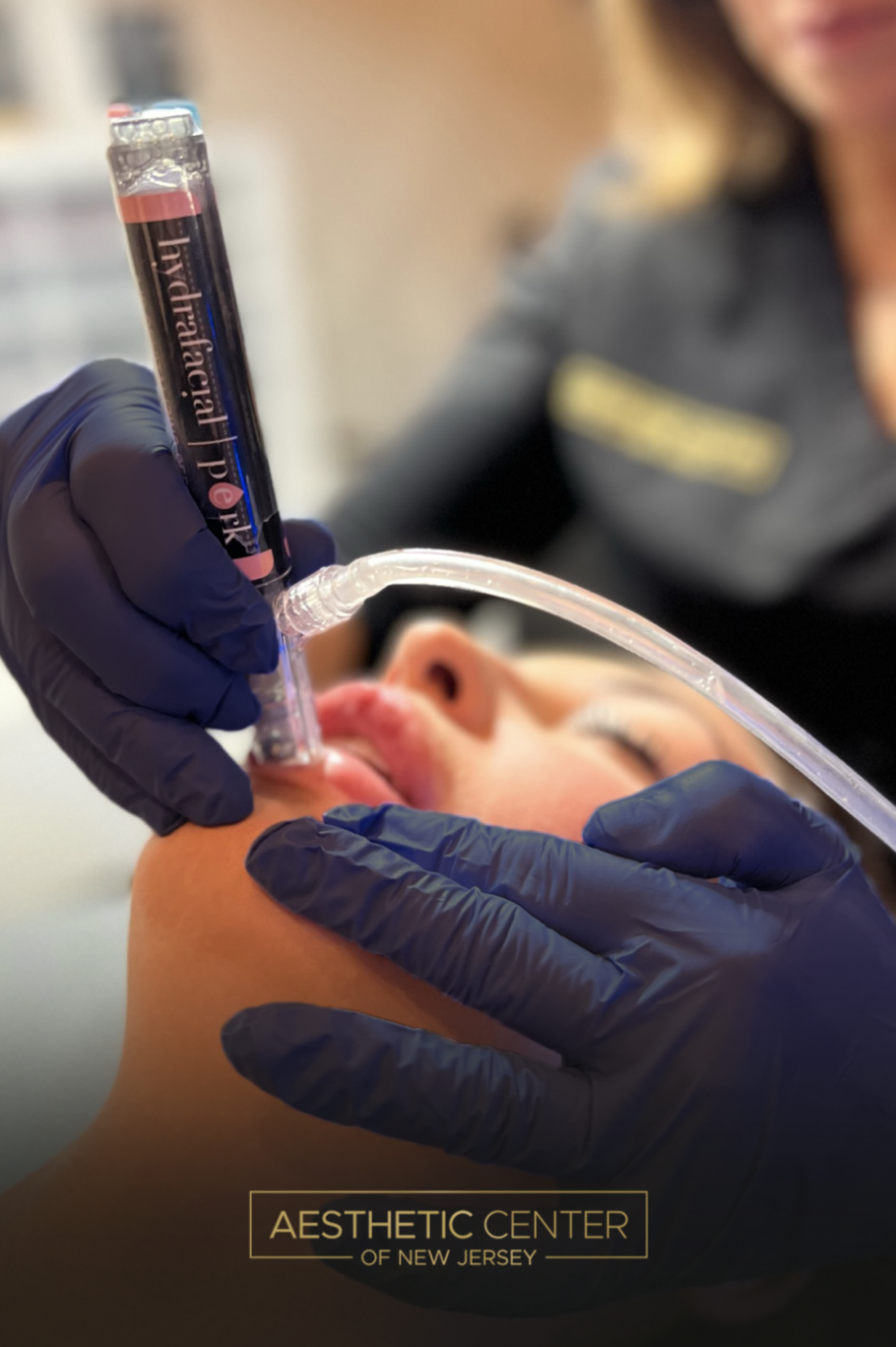 Young woman receiving Hydrafacial Lip Perk add-on.