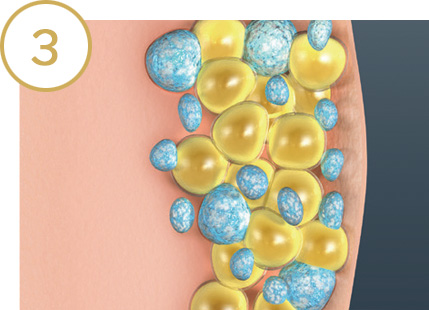 Fat cells in the body being naturally eliminated after a CoolSculpting treatment.